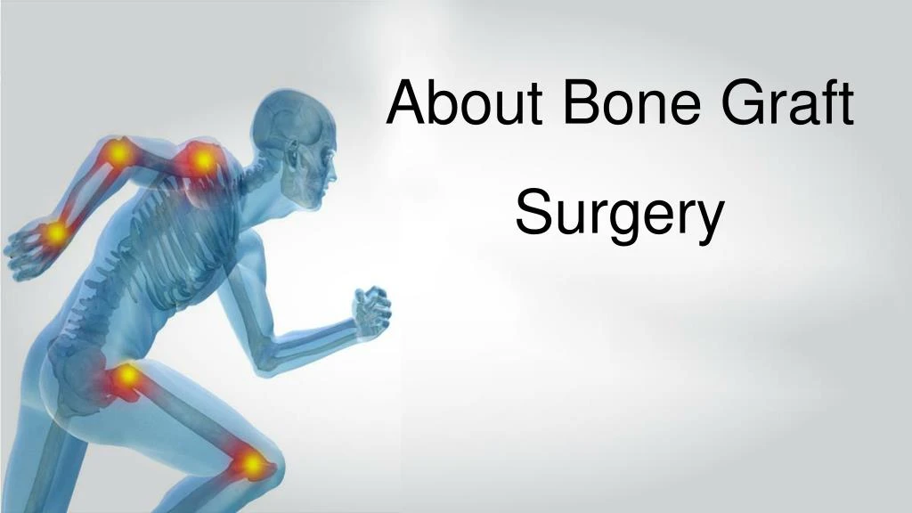 about bone graft surgery