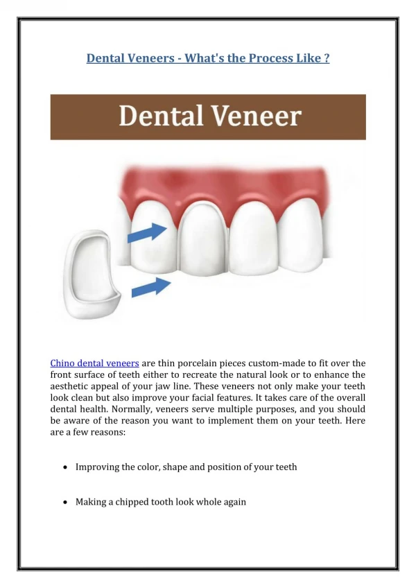 Dental Veneers - What's the Process Like?