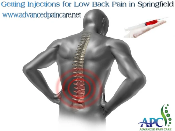 Getting Injections for Low Back Pain in Springfield