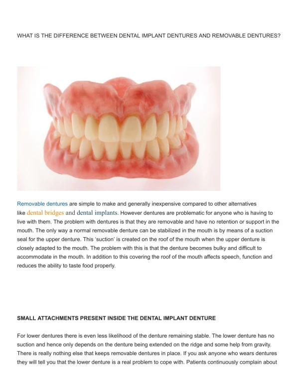 WHAT IS THE DIFFERENCE BETWEEN DENTAL IMPLANT DENTURES AND REMOVABLE DENTURES?