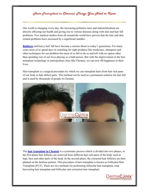 Hair Transplant in Chennai- Things You Need to Know