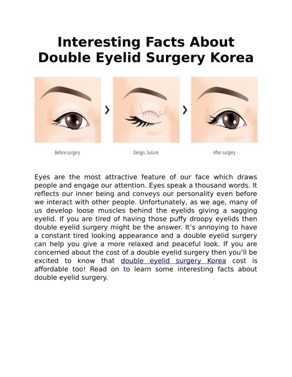 Interesting Facts About Double Eyelid Surgery Korea