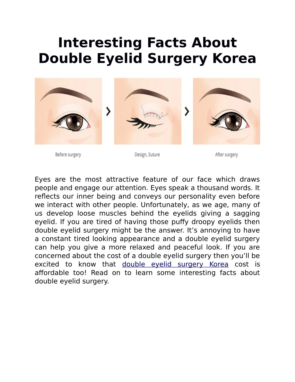 interesting facts about double eyelid surgery
