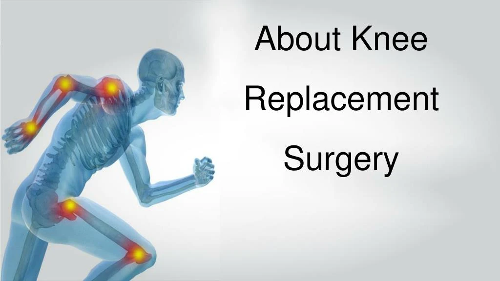 about knee replacement surgery