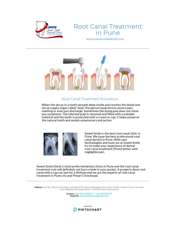Find Best Dentist for Root canal treatment in Pune - Sweet Smile Dental Clinic