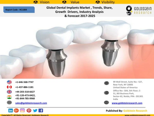 Global Dental Implants Market , Trends, Share, Growth Drivers, Industry Analysis & Forecast 2017-2025