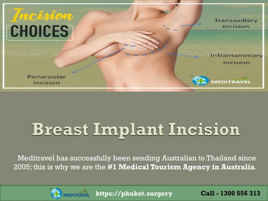 breast implant incision
