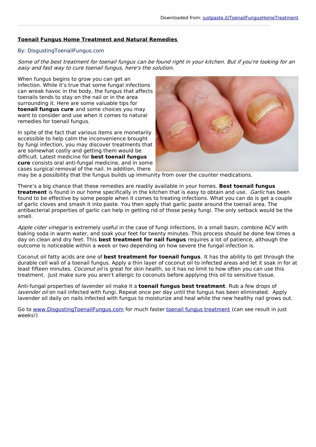 Nail fungus: Diagnosis and treatment