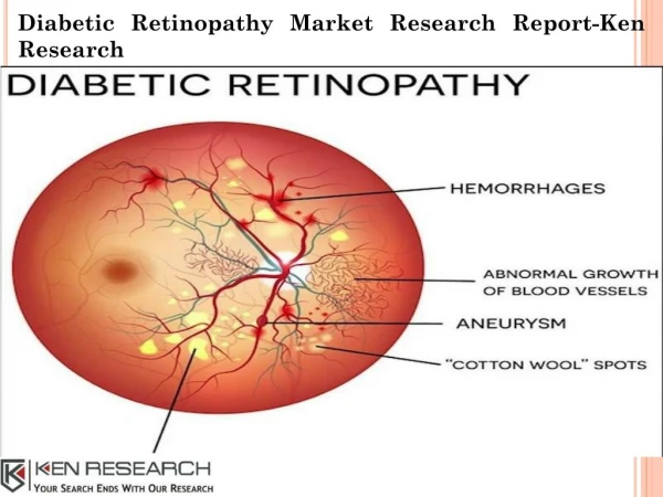 Diabetic Retinopathy Market Size, Diabetic Retinopathy Market Future Outlook-Ken Research