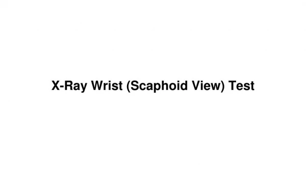 X ray wrist (scaphoid view) test