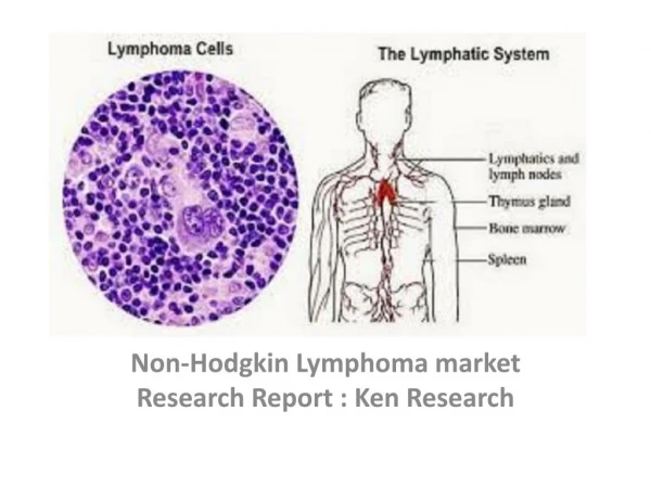 Non-Hodgkin lymphoma Market Report, Key Players, Analysis, Scope, Pipeline Products, Trends, Revenue : Ken Research