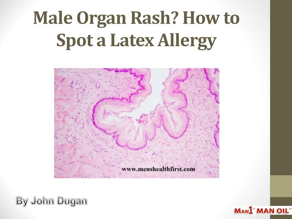 male organ rash how to spot a latex allergy