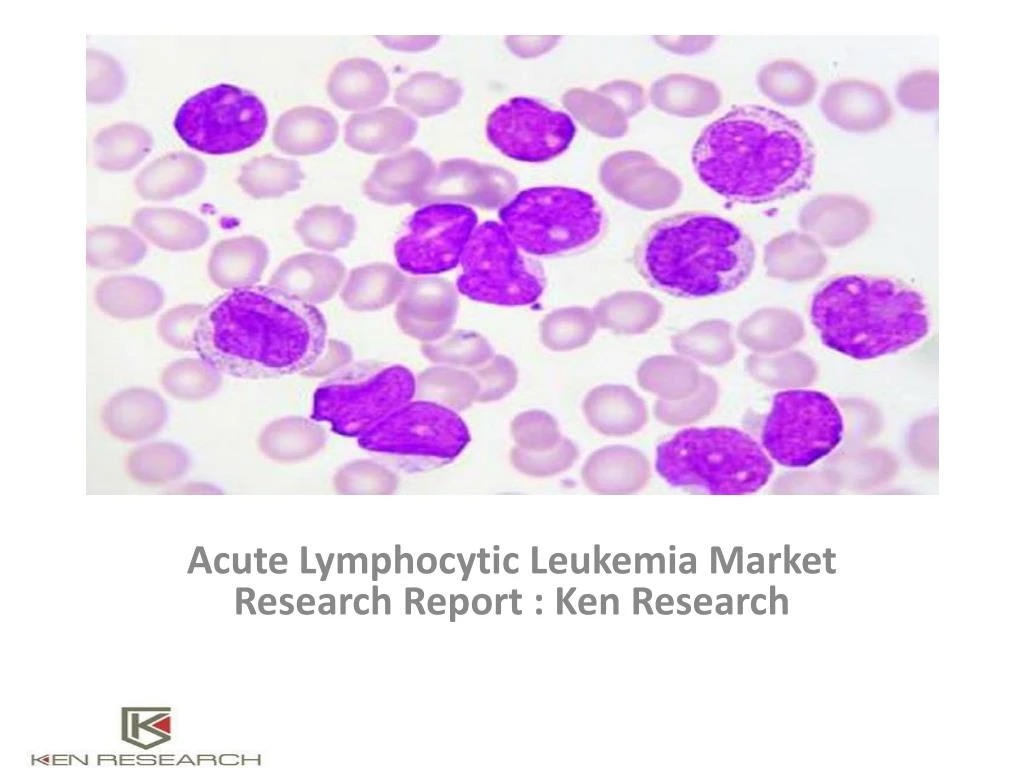 acute lymphocytic leukemia market research report ken research