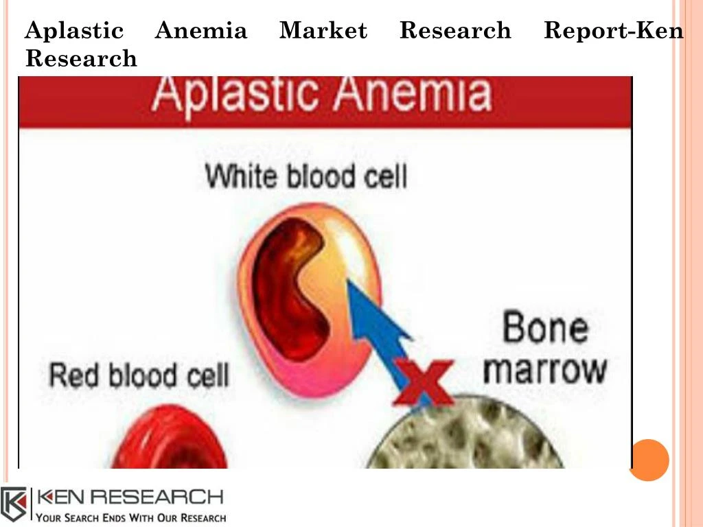 aplastic anemia market research report