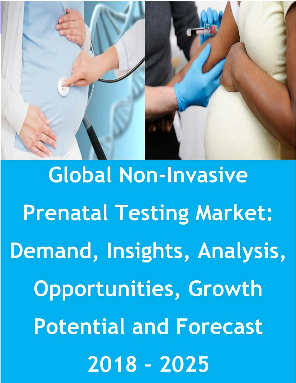 global nipt test market