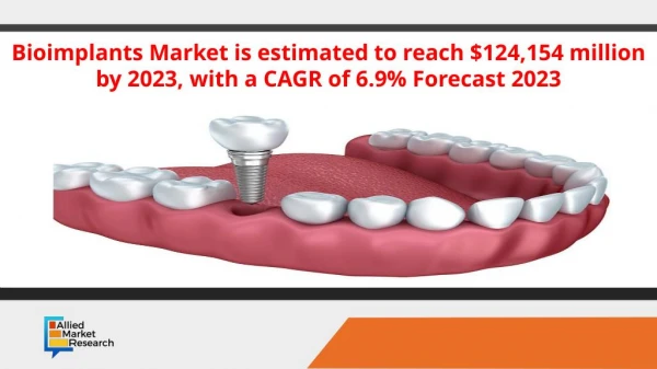 Bioimplants Market is estimated to reach $124,154 million by 2023, with a CAGR of 6.9% Forecast 2023