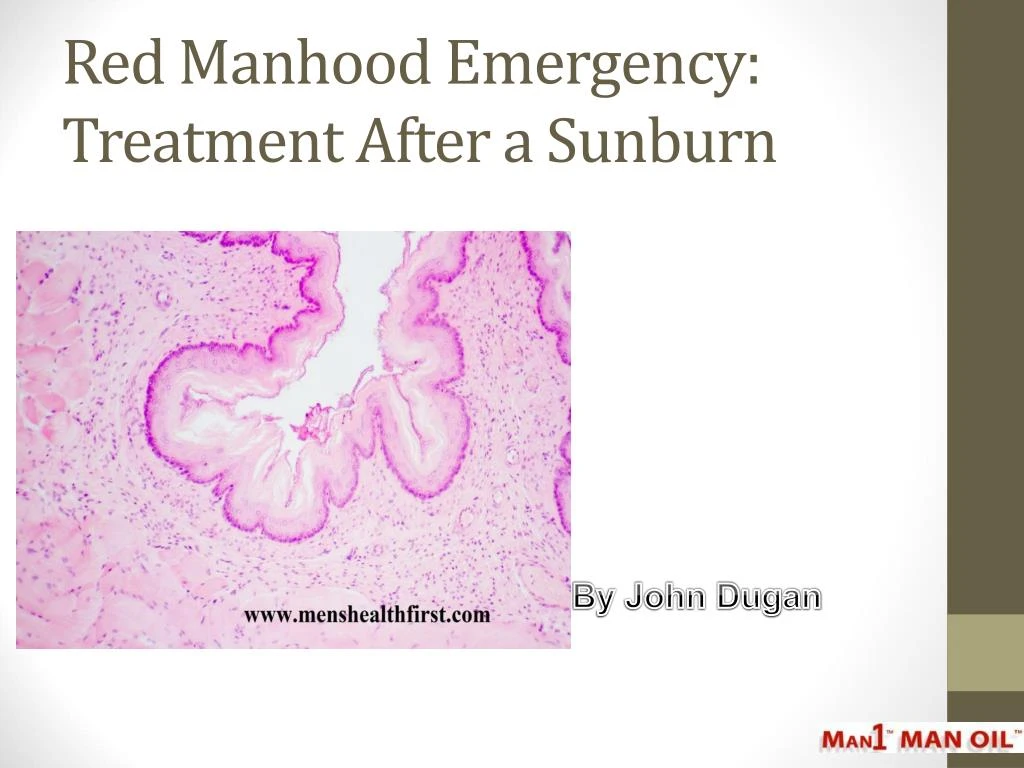 red manhood emergency treatment after a sunburn