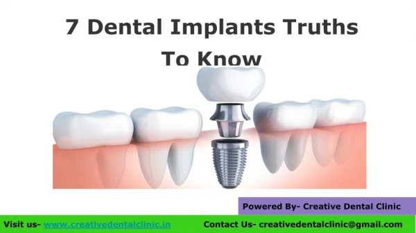 7 Dental Implants Truths To Know