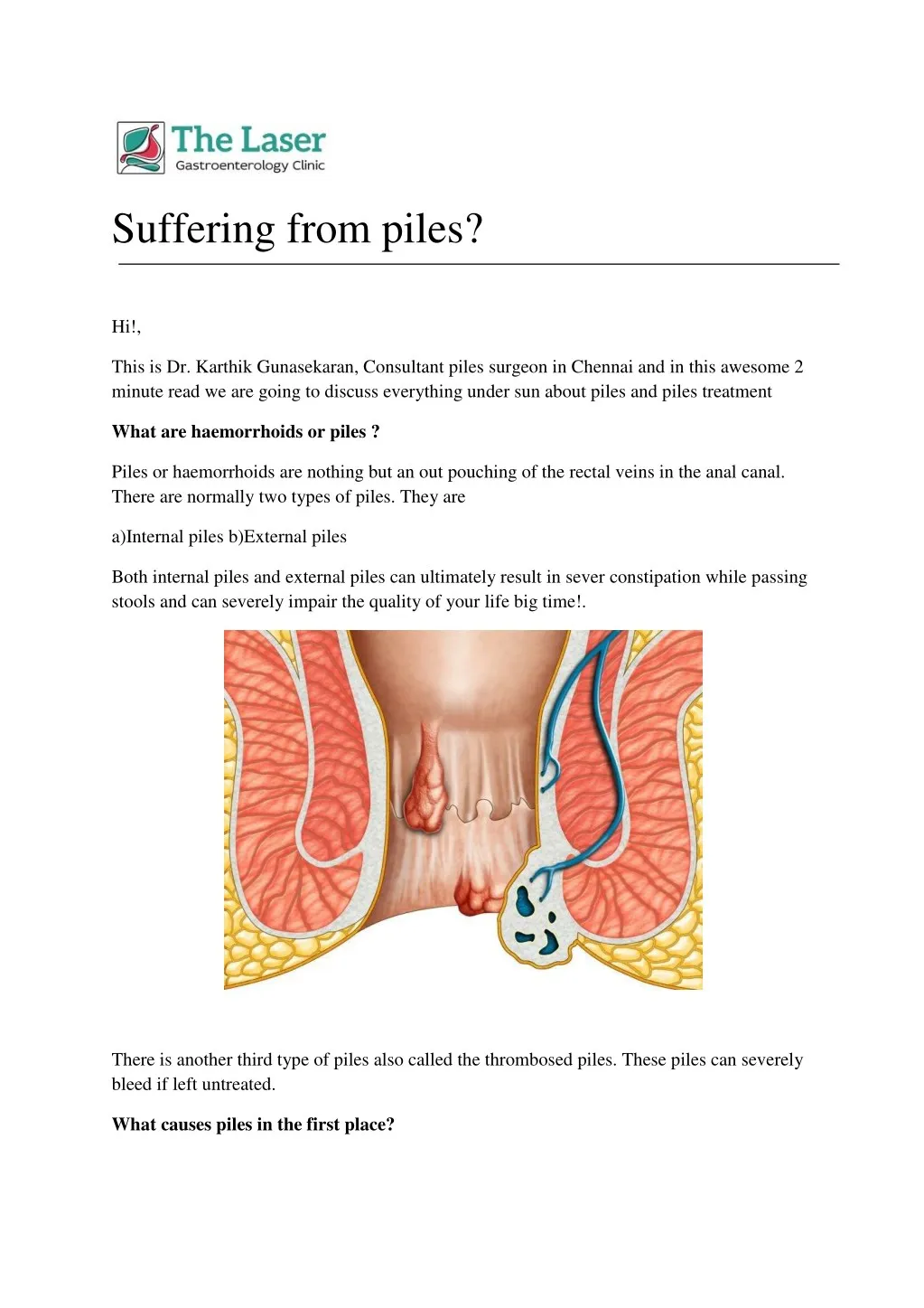 suffering from piles