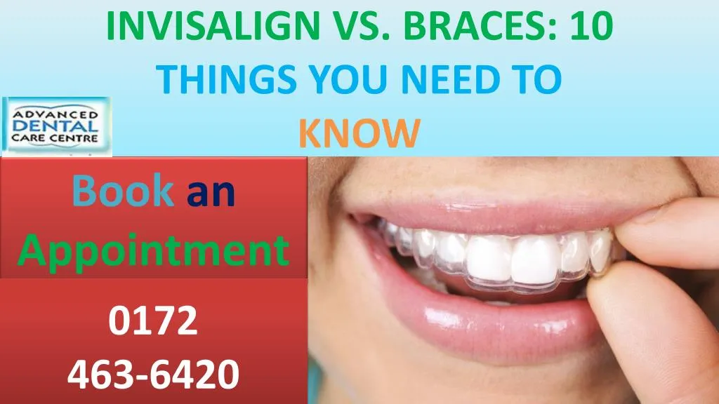invisalign vs braces 10 things you need to know