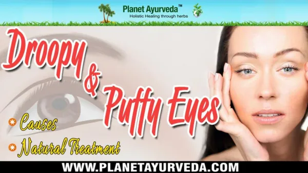 Causes & Natural Treatment for a Droopy and Puffy Eyes
