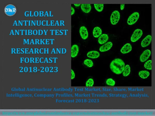 Antinuclear Antibody Test Market Research