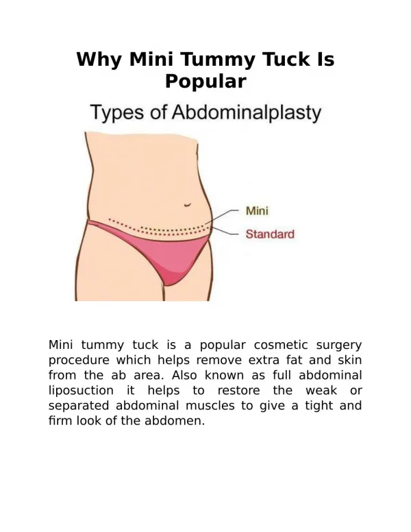 Why Mini Tummy Tuck Is Popular