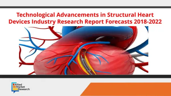 Technological Advancements in Structural Heart Devices Industry Research Report Forecasts 2021