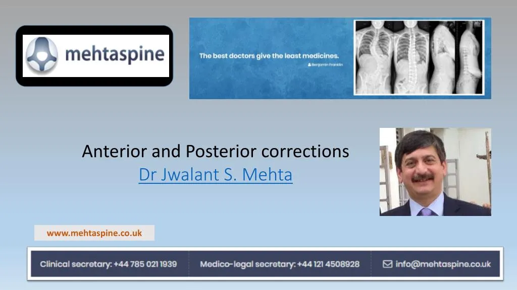 anterior and posterior corrections dr jwalant