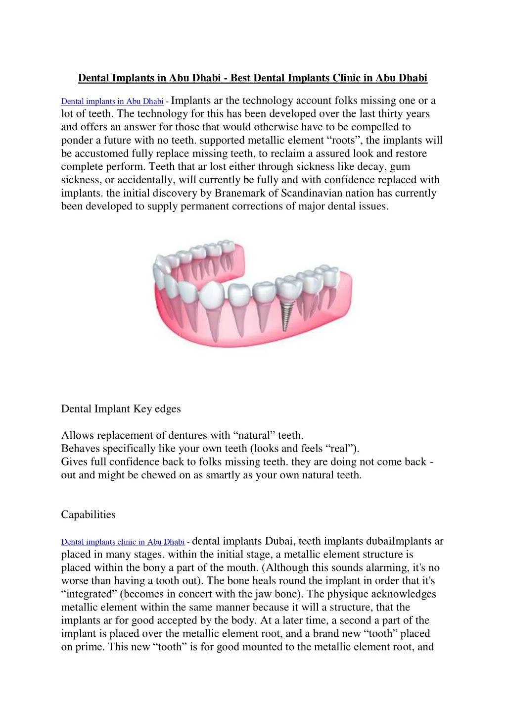 dental implants in abu dhabi best dental implants