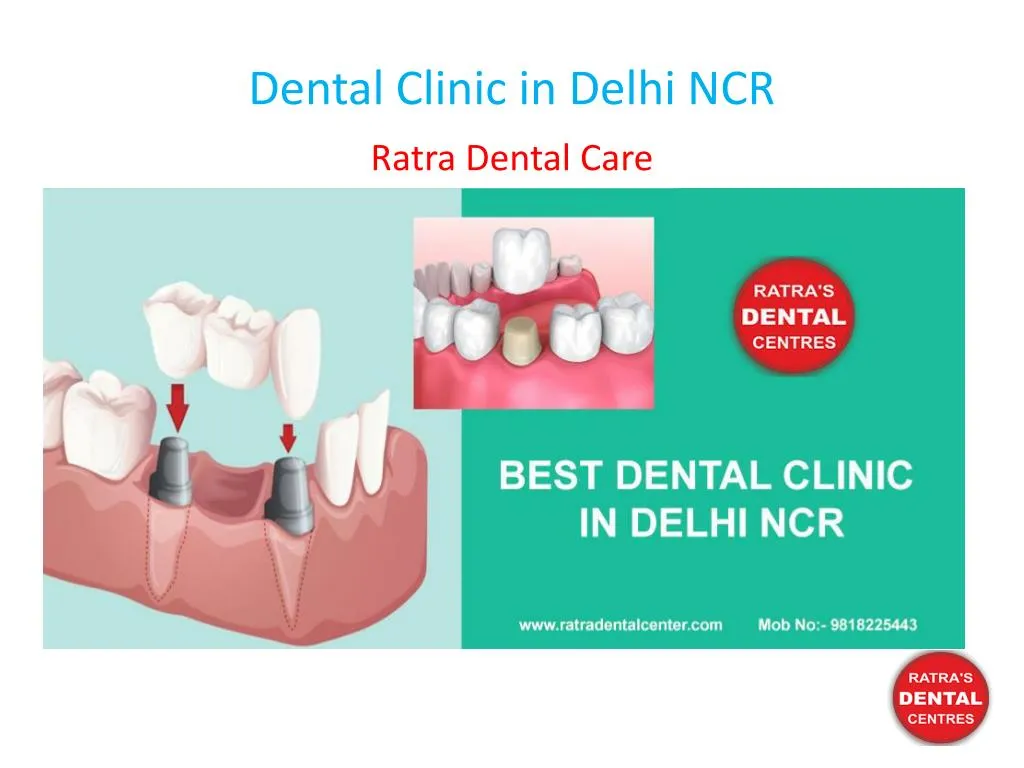 dental clinic in delhi ncr