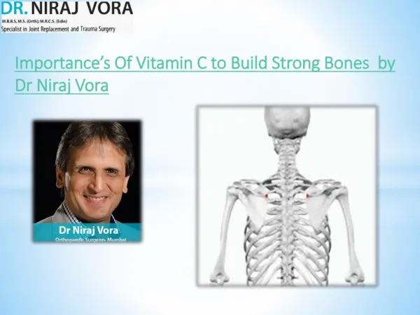 Dr Niraj Vora - Importance Of Vitamin C to Build Strong Bones