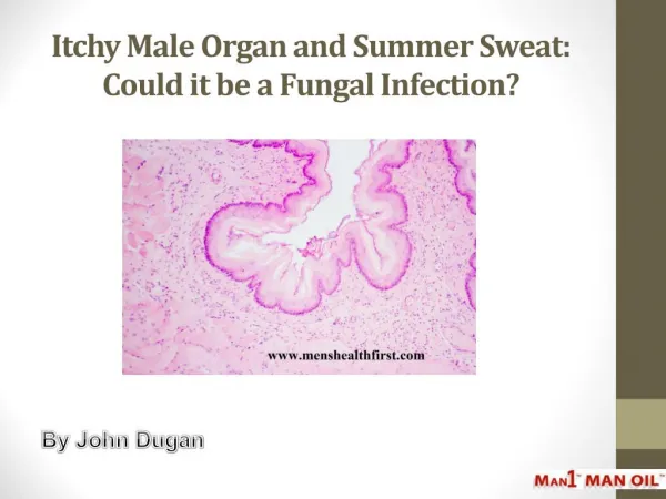Itchy Male Organ and Summer Sweat: Could it be a Fungal Infection?