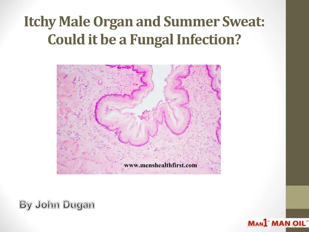 itchy male organ and summer sweat could it be a fungal infection