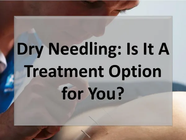 Dry Needling: Is It A Treatment Option for You?