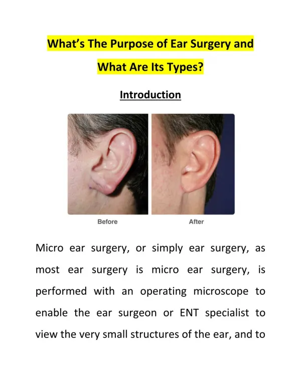 What’s The Purpose of Ear Surgery and What Are Its Types?
