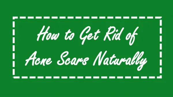 How to Get Rid of Acne Scars Naturally