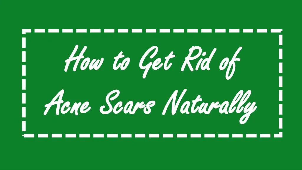 how to get rid of acne scars naturally