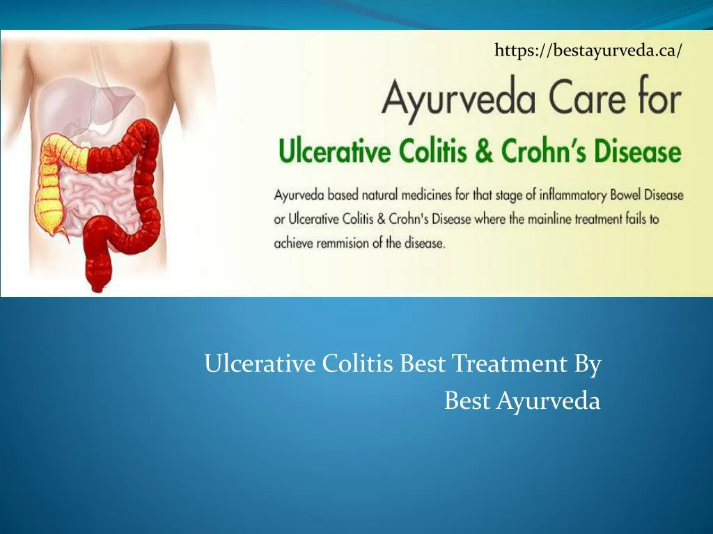 ulcerative colitis best treatment by best ayurveda