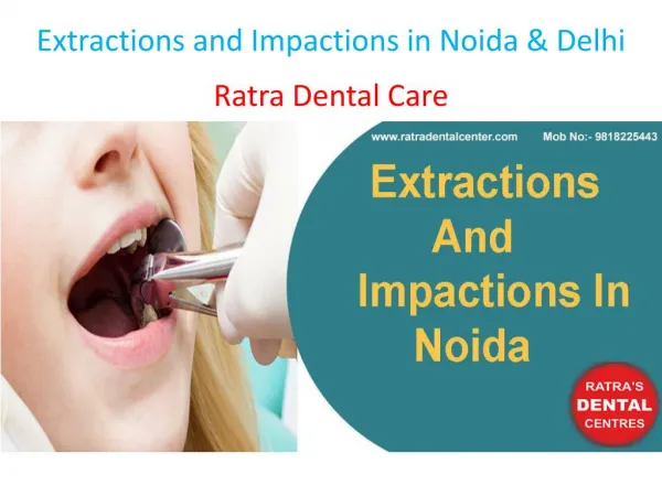 Extractions and Impactions in Noida & Delhi