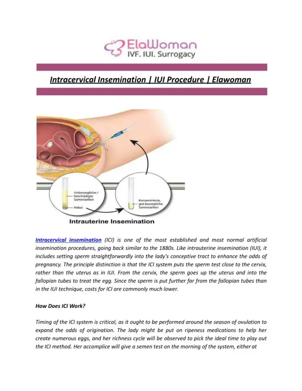 Intracervical Insemination | IUI Procedure | Elawoman