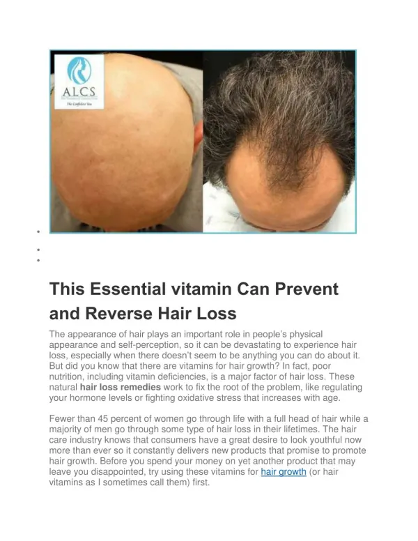 This Essential vitamin Can Prevent and Reverse Hair Loss