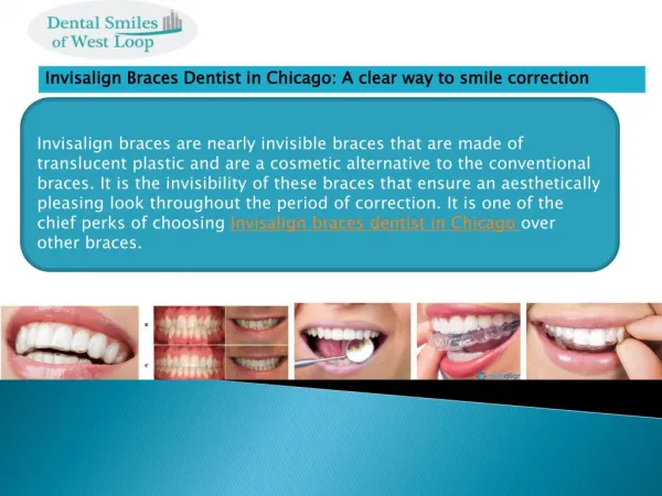 Invisalign Braces Dentist in Chicago: A clear way to smile correction