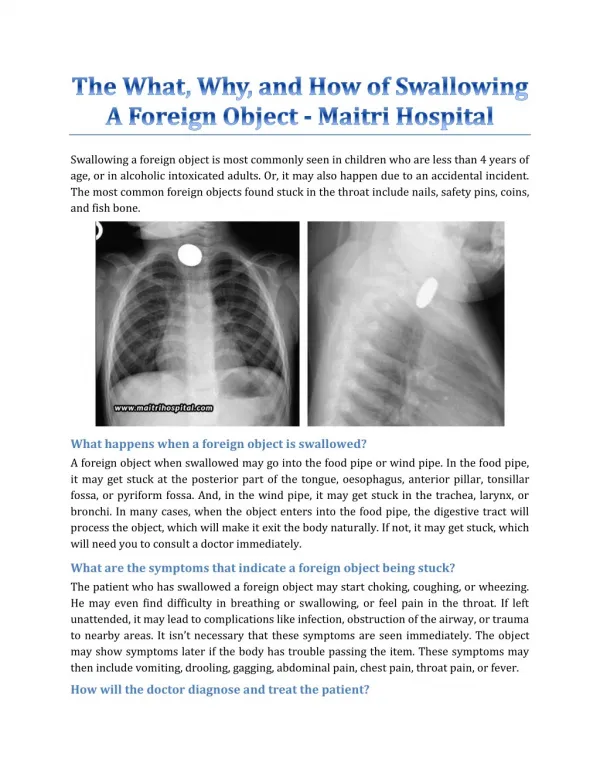 The What, Why, And How Of Swallowing A Foreign Object - Maitri Hospital