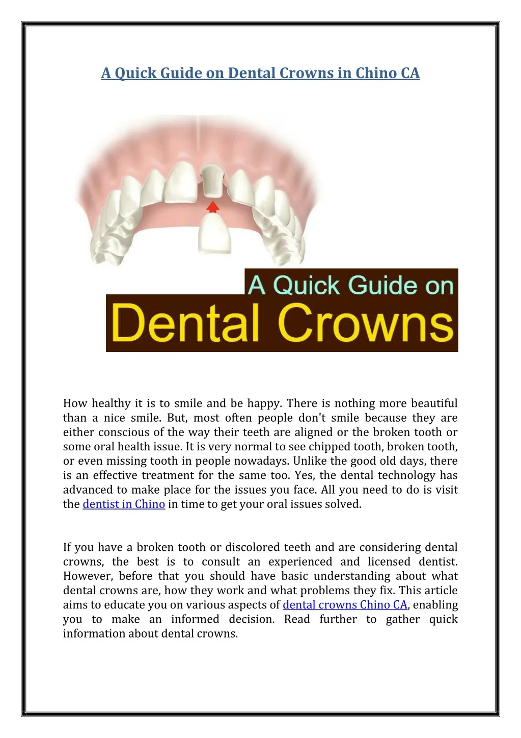 a quick guide on dental crowns in chino ca
