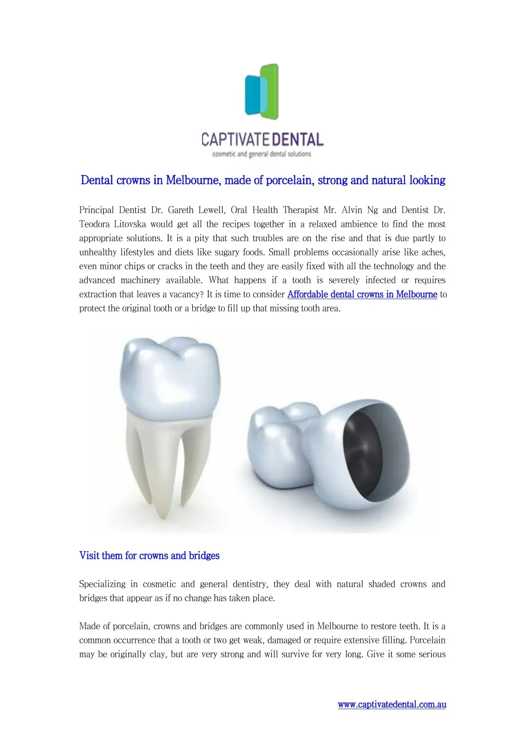 dental dental crowns