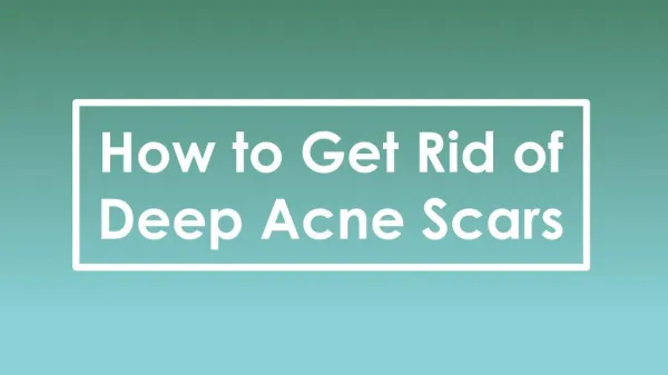 How to get Rid of Deep Acne Scars