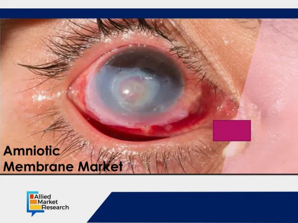 Amniotic Membrane Market by Product and Application 2023