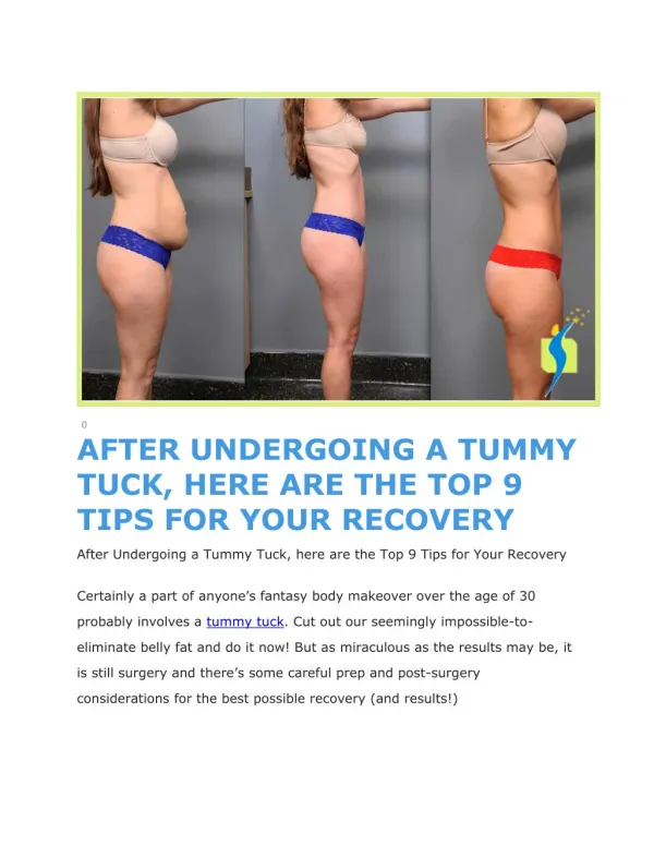 AFTER UNDERGOING A TUMMY TUCK, HERE ARE THE TOP 9 TIPS FOR YOUR RECOVERY
