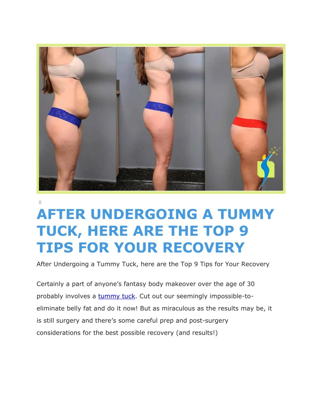 0 after undergoing a tummy tuck here